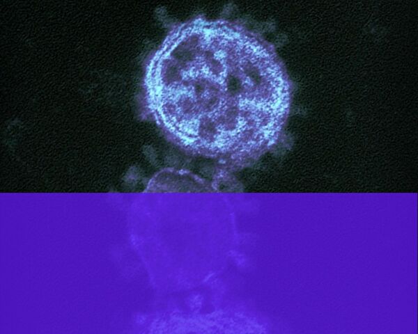 Coronavirus